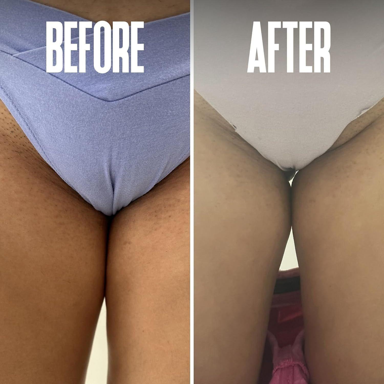 Divine Derriere Ingrown Hair Pads - 50 Pads | Exfoliating Razor Bump & Ingrown Hair Treatment